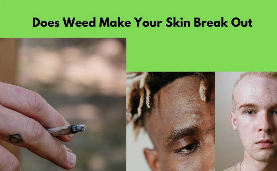 Does Weed Make Your Skin Break Out